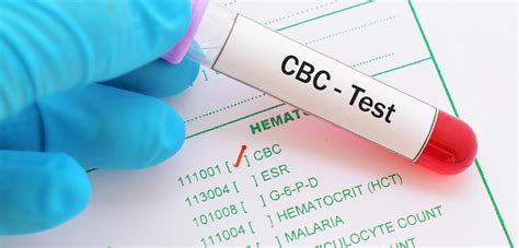 7. Complete Blood Count (CBC)